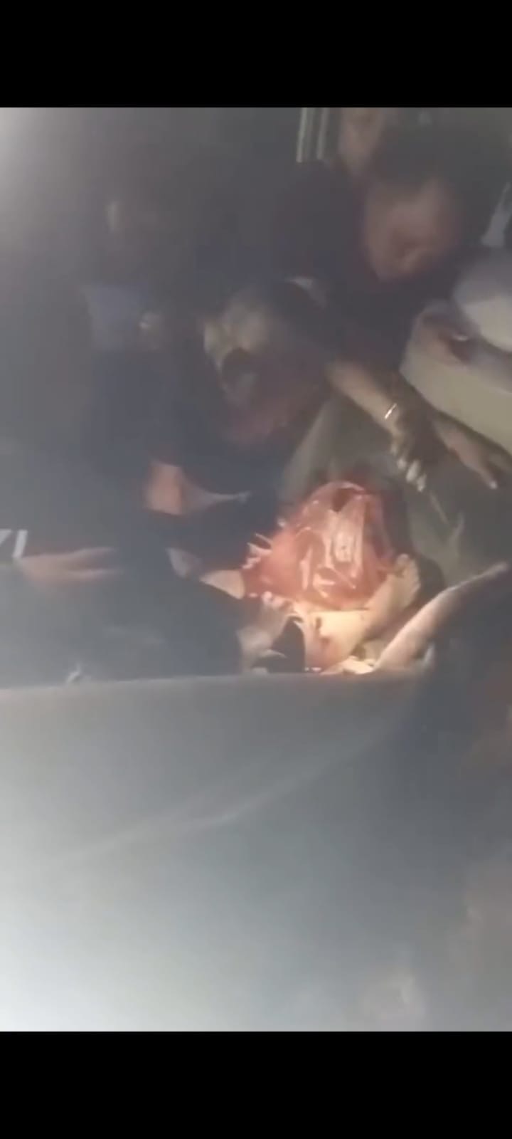 Foto : Tangkapan layar 2 korban diduga diserang buaya di Desa Lampuyang.(IST)